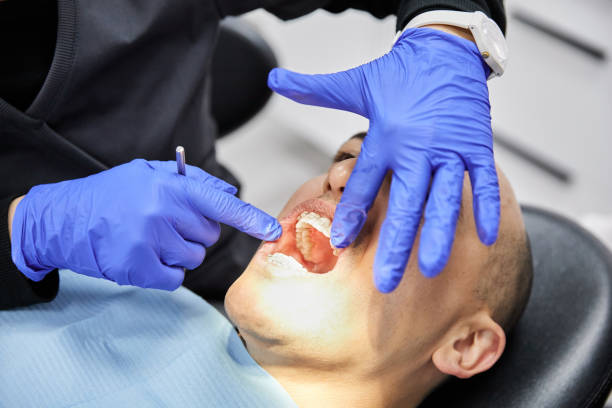 Best Broken Tooth Emergency  in West Menlo Park, CA